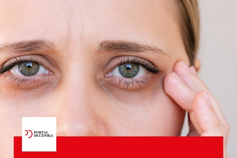 Umorzenie postępowania windykacyjnego w sądzie w praktyce Umorzenie postępowania windykacyjnego w sądzie w praktyce